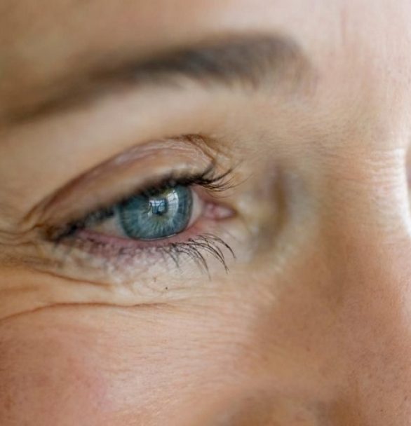 5 روش برای مراقبت از پوست دور چشم